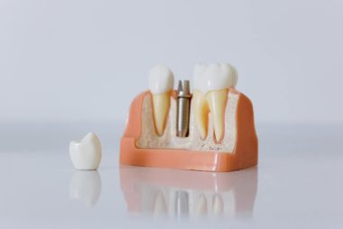 Budowa morfologiczna zęba